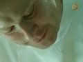 14,650ポンド。なぜ歯科医は、施術中に凍りついたのか / Volkswagen「Dentist」 シーン 4